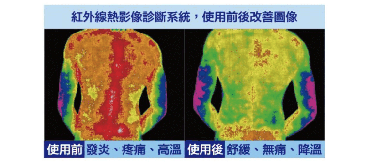 安泰-LA200I-多頻道雷射暨電刺激治療儀-雷射針灸